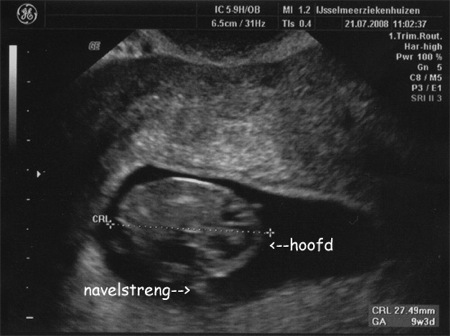 echo21072008_01