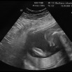 echo15102008_01