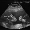 echo15102008_02