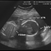 echo15102008_03