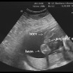 echo15102008_04